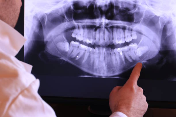 Best Emergency Broken Tooth Repair in Galls, IN