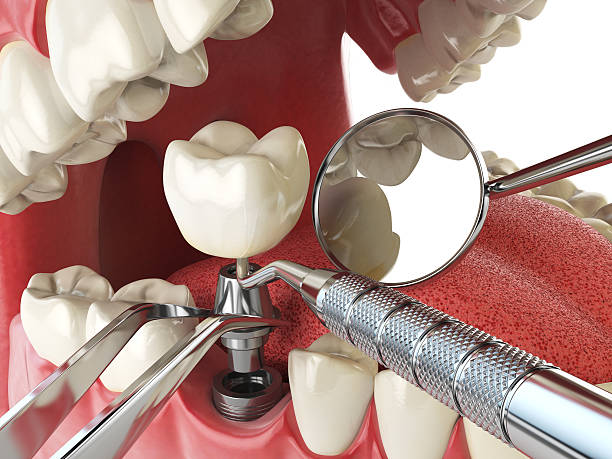 Best After-Hours Emergency Dentist in Galls, IN